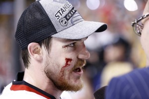 Toughness is one of the many intangibles of Andrew Shaw.
